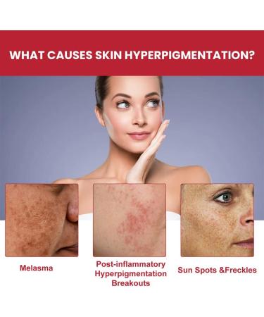 Dajidafu Women Face Whitening Brightening Girls Natural Ingredient Moisturizing Essence Female Portable Stock Solution - Buy Online on SooperMarket.com