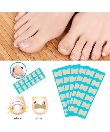 Toenail Patch Ingrown Toenail Toenail Correction Toenail Correction Patch Toenail Correction Patch Ingrown Toenail Nail Care 50 Pieces - Buy Online on SooperMarket.com