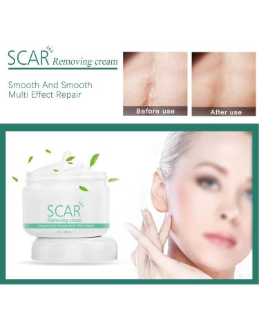 Jopwkuin Scar Removal Cream - Reduce Wrinkles & Soothe Surgery Scars - For Men - Buy Online on SooperMarket.com