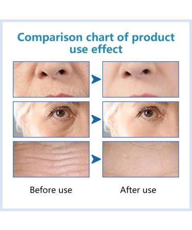 Hyalu B5 Serum Hyaluronic Acid B5 Serum Anti Aging Serum Face Serum Concentrate Hyaluronic Acid Serum for Face - Anti Aging Instant Face Firming & Plumping Face Fade Fine Lines 30ml - Buy Online on SooperMarket.com