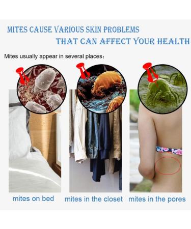 Kybbe Mite Remove Soap with Goat's Milk and Sea Salt - Eliminates Mites, Nourishes Skin - Gentle Personal Care - Buy Online on SooperMarket.com