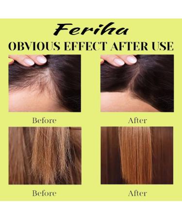 Hair Growth Advanced - Unisex Biotin & Rosemary Oil Formula for Thicker Fuller Hair | Combat Hair Loss & Damage Internationally Shipped - Buy Online on SooperMarket.com
