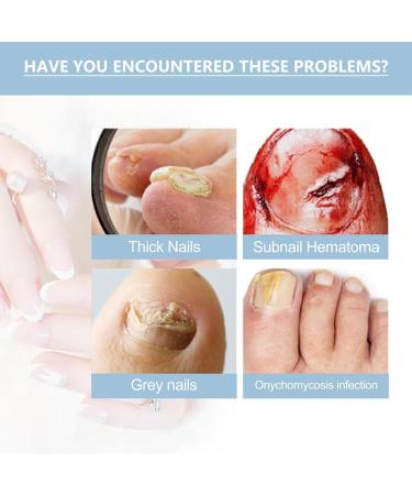 HOPASRISEE Onyxoguard Nail Growth and Repair Serum Onyxoguard Serum Nail Strengthener Nail Growth Serum Nail Growth and Strengthener Nail Serum for Strength and Growth (1) - Buy Online on SooperMarket.com
