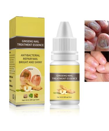 Tbeautfave Fungal Nail Treatment Nail Fungus Treatment for Toenail Ginseng Nail Treatment Essence Nail Growth Treatment Relief Oil Nail Repair Solution Toenail Oil Treatment Nail Care