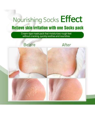 Epielle Nourishing Foot Masks - Hemp + Rosemary Extract (6pk) | Deep Moisturizing, Vegan & Cruelty-Free Socks | Beauty & Skincare Gifts, Party Favors, Stocking Stuffers - Buy Online on SooperMarket.com