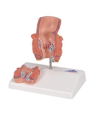 3B Scientific K27 Hemorrhoid Model 5.5-Inchx3.9-Inchx5.5-Inch - Buy Online on SooperMarket.com