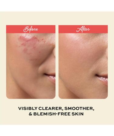 Buy Clarifying Toner with Salicylic Acid - Oil Control & Spot Treatment | Cruelty-Free Skincare | 7.04 oz by The Natural and Organic Family - International Shipping Available - Buy Online on SooperMarket.com