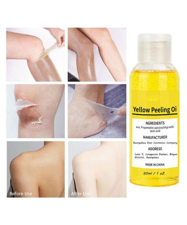 Super Strength Yellow Peeling Oil for Dark Skin - 30/50ml Exfoliating Lightening Treatment - Extra Strength for All Skin Types - Buy Online on SooperMarket.com