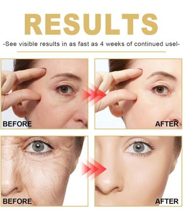 Dajidafu Women Face Wrinkle Remover Ladies Moisturizing Brightening Anti-wrinkle Essence Dark Spot Removal Skin Care 30ml - Buy Online on SooperMarket.com