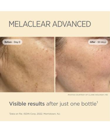 Isdinceutics Melaclear Advanced Dark Spot Corrector with Niacinamide 1.7 FL OZ - Buy Online on SooperMarket.com