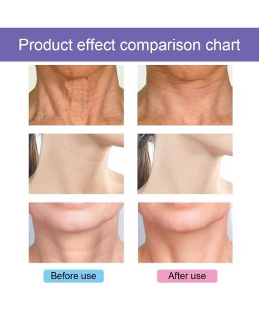 Neck Firming Cream Strengthen Neck Cream Neck Firming Cream Tightening Lifting Sagging Skin Aging Skin & Saggy Skin Anti Aging Neck Cream Reduce Wrinkles & Smoothing Neck Fine Lines-Neck and Body 40g - Buy Online on SooperMarket.com
