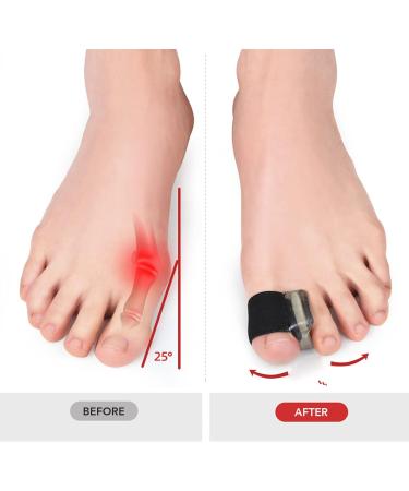 Bunion Corrector Toe Separators for Men - Flexible Relief and Prevention - Buy Online on SooperMarket.com