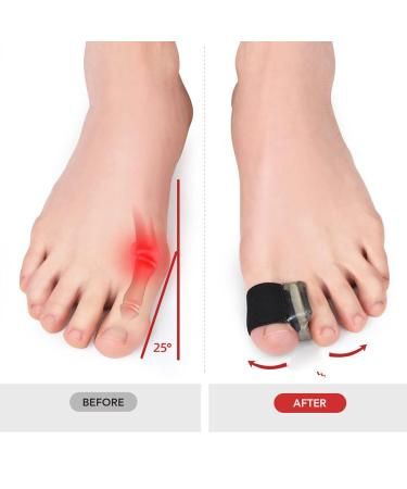 Flexible Bunion Relief Toe Separators - 6 Pairs for Women | Prevent Friction and Correct Bunions | Hard Wearing Toe Spacers - Buy Online on SooperMarket.com