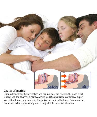Snoring Patches: Sleep Tape for Better Nose Breathing, Improve Night Sleep - Buy Online on SooperMarket.com