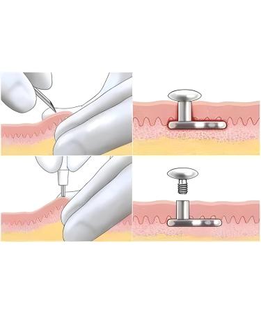 Disposable Sterile Biopsy Punch - 5mm Stainless Steel Dermal Piercing Tool | Safe Skin Punch for Accurate Biopsies | 1pc - Buy Online on SooperMarket.com