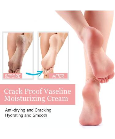Cracked Heel Repair Cream Stick Foot Moisturizing Stick Foot Cream For Very Dry Feet Foot Cream For Calluses And Hard Skin Foot Moisturiser Callus Remover Soften For Feet Knees Hand - Buy Online on SooperMarket.com