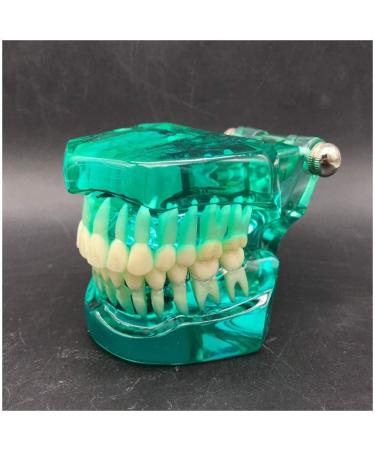 Transparent Dental Model for Adult Dentists | Realistic Teeth & Gums for Teaching & Demonstration - International Shipping - Buy Online on SooperMarket.com