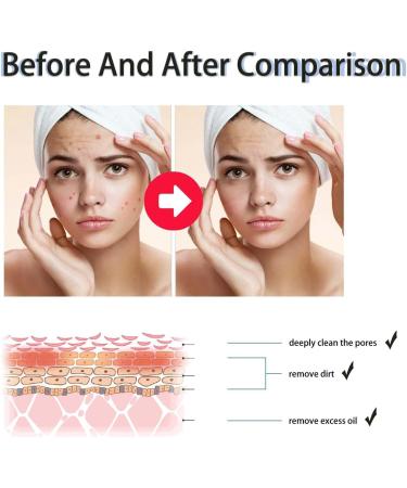 GeRRiT Poreclear 2% BHA Skin Fluid Facial Skin Refining Serum Skin Liquid Facial Exfoliator Facial Exfoliating Serum 2pcs - Buy Online on SooperMarket.com