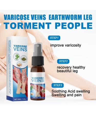 Veinhealing Varicose Veins Spray - Remove Spider Veins & Soothe Legs | 30ml Treatment for Improved Blood Circulation - Buy Online on SooperMarket.com
