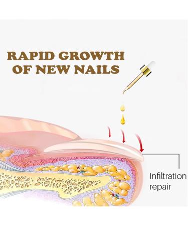 NailGrowth DeepHealing Organic Serum NailGrowth Serum Reconstrux Nail Growth Nail Growth and Strength Serum Nail Growth Serum Nail Repair Essence Serum 30ml (3Pcs) - Buy Online on SooperMarket.com