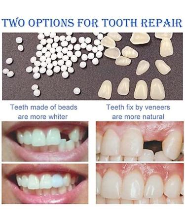 ChezMax Temporary Tooth Repair Kit - Fix Missing & Broken Teeth - Natural Solution - Buy Online on SooperMarket.com