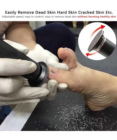 Electric Callus Remover with Adjustable Speed and 60pcs Sandpaper Disks - Professional Foot File for Dead Skin Removal - FCR-01 Black - Buy Online on SooperMarket.com