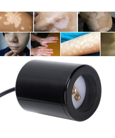 UV 308NM Vitiligo Physiotherapy Instrument for Psoriasis, Eczema & Pityriasis Rosea - Buy Online on SooperMarket.com