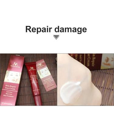 FOMIYES Pregnancy Scar Removal Cream - Fade Safe Anti-Stretch Mark Whitening Ointment - 2pcs Redx2pcs - Buy Online on SooperMarket.com
