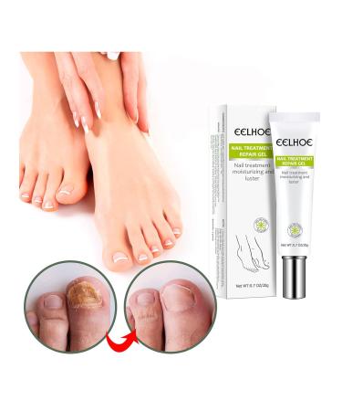 Yueci Hand and Foot Care Cream - Heal & Repair Damaged Nails | Nail Treatment for Cracked & Split Toes - Buy Online on SooperMarket.com