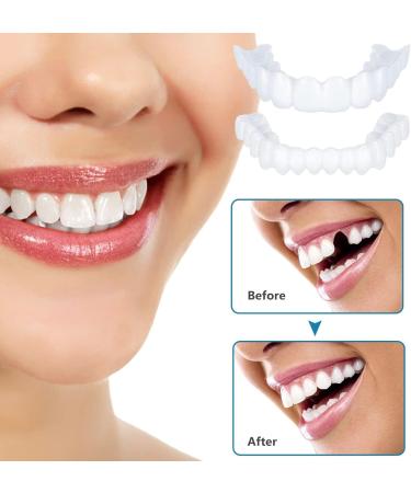 Derlen False Teeth Temporary Repair Kit - 2 Pairs of Top & Bottom Lightening Dentures for Men & Women | Easy-to-Use Braces - Buy Online on SooperMarket.com
