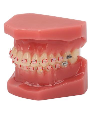 Orthodontic Demonstration Model for Dental Research | Metal Wires & Ceramic Brackets | Teaching Aids for Adults - Buy Internationally - Buy Online on SooperMarket.com