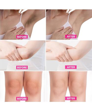 Dark Spot Corrector Cream for Body & Intimate Areas - 2PCS x 60ML - Buy Online on SooperMarket.com