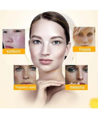 Dark Spot Remover Cream for Face, Body & Sensitive Areas - With Alpha Arbutin, Niacinamide, Collagen, Vitamin E - Powerful Age Spot Corrector - Buy Online on SooperMarket.com