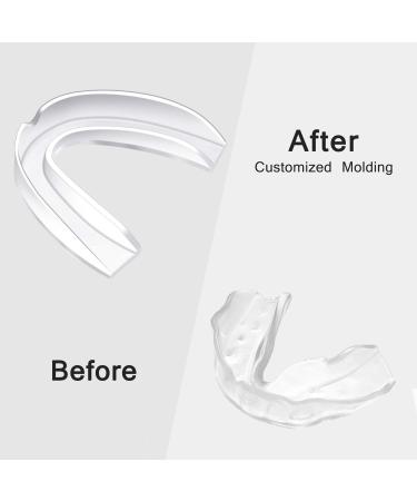BBTO 20 Pieces Sports Mouth Guards - Transparent Athletic Mouth Guard for Kids and Adults - Buy Online on SooperMarket.com