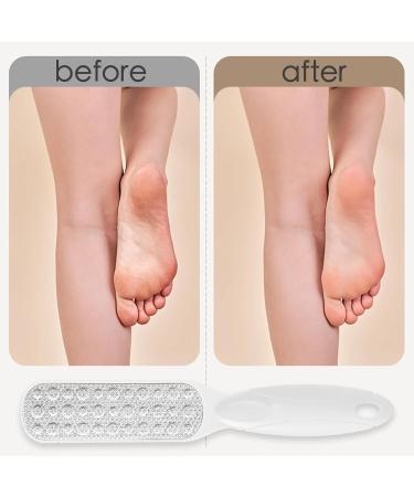 Foot File Foot Scraper for Hard Skin Professional Pedicure Double Side Foot Files Callus Remover Foot Scrubber Metal Foot Rasp Foot Care Tool for Dead Skin Cracked Heels Corn Removal - Buy Online on SooperMarket.com