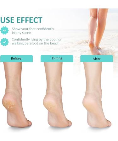 Glass Foot File Callus Remover for Dead Skin Removal - Pedicure Tool for Soft, Smooth Feet - Foot Scrubber and Heel Scraper - Ideal for Men and Women - Buy Online on SooperMarket.com