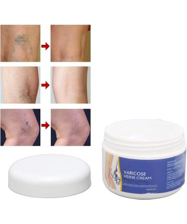 50g Natural Varicose Veins Cream | Leg Circulation & Spider Vein Remover | Cooling Effect | Ointment - Buy Online on SooperMarket.com