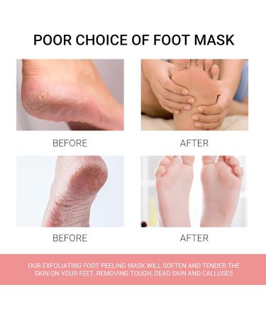 3 Pair Foot Peeling Mask Socks - Moisturizing Foot Mask for Dry & Cracked Feet - Easy Corn Removal - Foot Spa Treatment for Men & Women - Buy Online on SooperMarket.com