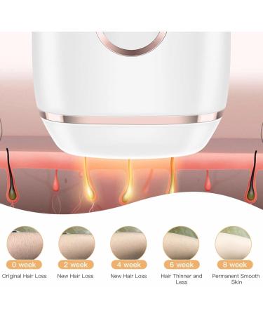 Gerrit Laser Hair Removal - Permanent & Sustainable Hair Remover for Face Legs Armpits & Bikini Zones | Shop Now! - Buy Online on SooperMarket.com