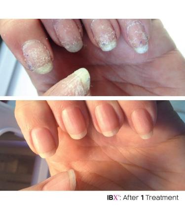 Buy IBX Mini Duo Pack Nail Polish | FREE Dadi Oil | Restore & Protect Your Nails Internationally - Buy Online on SooperMarket.com