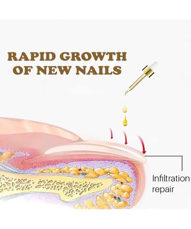 NailGrowth DeepHealing Organic Serum NailGrowth Nail Serum Reconstrux Nail Growth Nail Growth and Strengthening Serum Nail Serum for Growth and Repair for Damaged Nails (3pcs) - Buy Online on SooperMarket.com