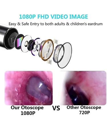KANDUO 4.5mm Ear Wax Removal Otoscope with 3 Million Endoscopes - 6 LED Light Ear Cleaner for Precision Earwax Removal - Buy Online on SooperMarket.com