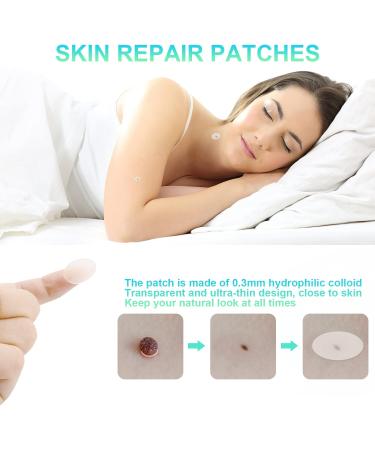 New Version Auto Skin Tag Remover Kit 2-Set Painless Skin Tag Removal Kit Tools for (1-9mm) Skin Tags (includes 100 Removal Bands & 36 Repair Patches & 20 Pcs Cleansing Wipes) Blue Green 2pcs Kit - Buy Online on SooperMarket.com