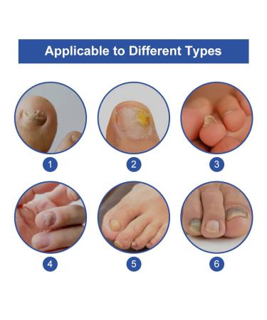 Premium Nail Care & Treatment | Repair Broken & Discolored Nails with Nourishing Nail Oil & Serum for Healthy Hands & Feet - Buy Online on SooperMarket.com