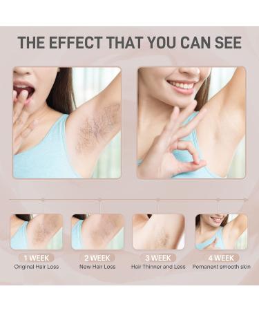 At-Home Permanent Laser Hair Removal Device | 999,999 Flashes | Painless Removal for Women and Men | Suitable for Armpits, Back, Legs, Arms, Face, and Bikini Line - White - Buy Online on SooperMarket.com