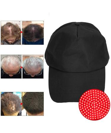 140 Laser Hair Regrowth Helmet - Effective Baldness Treatment for Men and Women - Buy Online on SooperMarket.com