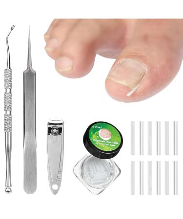 (12 +3) Ingrown Toenail Correction Treatment Kit Toenail Straightener Strips Recover Clips Plastics Ingrown Toenail Correction Strips Brace Kit for Women Men Ingrown Thick Nail