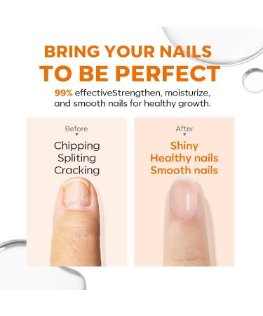 Modelones Nail Care 8-in-1 Ridge Filling Treatment for Stronger Nails | Nail Hardener, Base Coat, and Strengthener | 15ml - Buy Online on SooperMarket.com