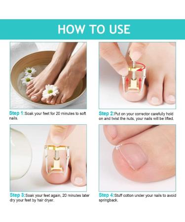 Ingrown Toenails Set Toenail Correction Toenail Toenail Patch Ingrown Toenails Tool Set Toenail Corrector Pedicure Tools Correction Sticker Toe Nails 21 Pieces - Buy Online on SooperMarket.com