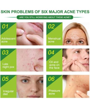 Acne Healing Patch Acne Absorbing Cover Invisible Skin Acne Treatment Stickers for Facial 24Patches acne treatment - Buy Online on SooperMarket.com